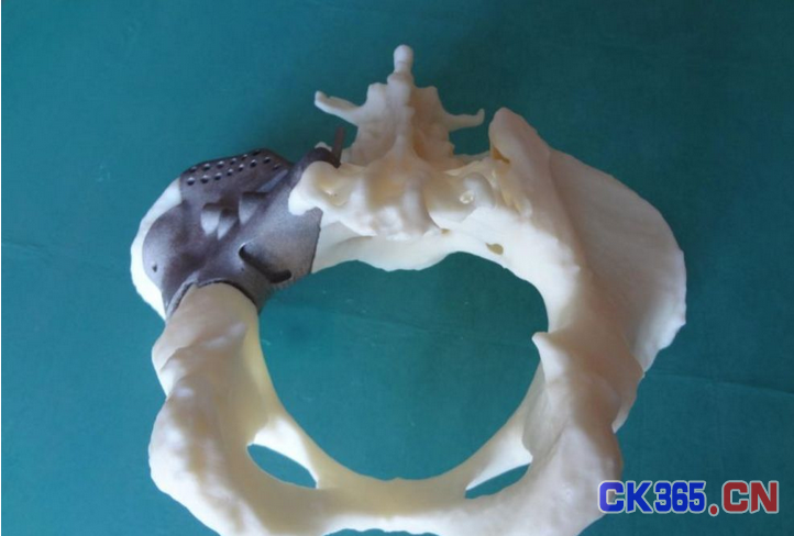 骨组织3D打印技术打印,成为骨再生的未来希望